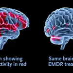 Pic - Diagram of FMRI-scan showing EMDR brain